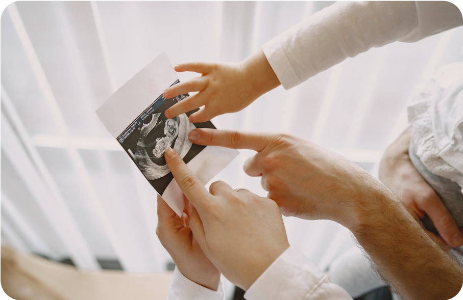 3D/4d Sonography